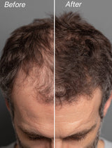 Hemp Seed Oil Anti-Hair Loss